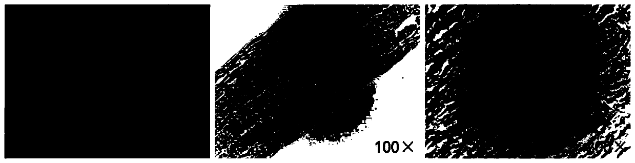 Acellular matrix inside-out repair material as well as preparation method and application thereof