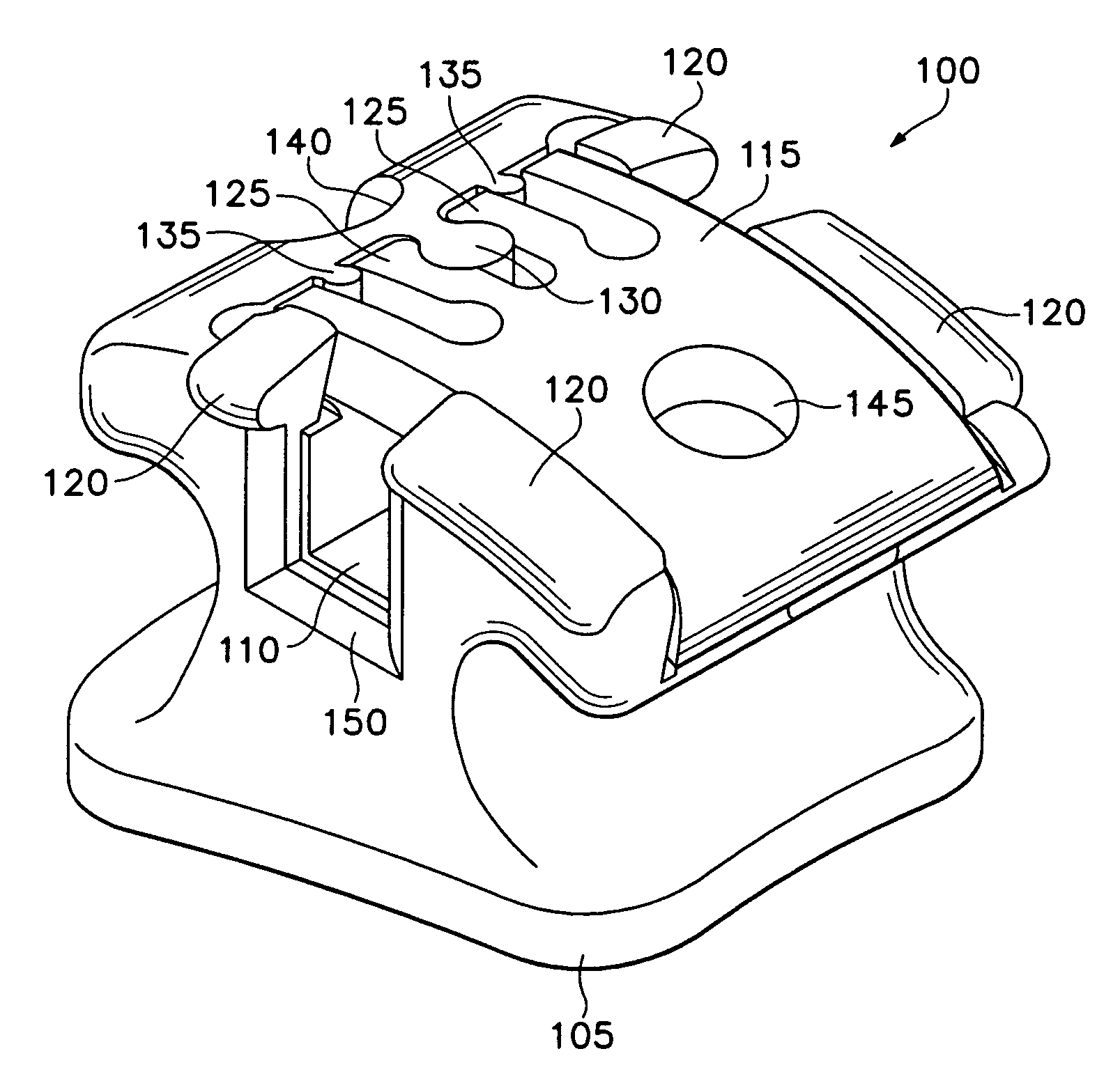 Orthodontic bracket