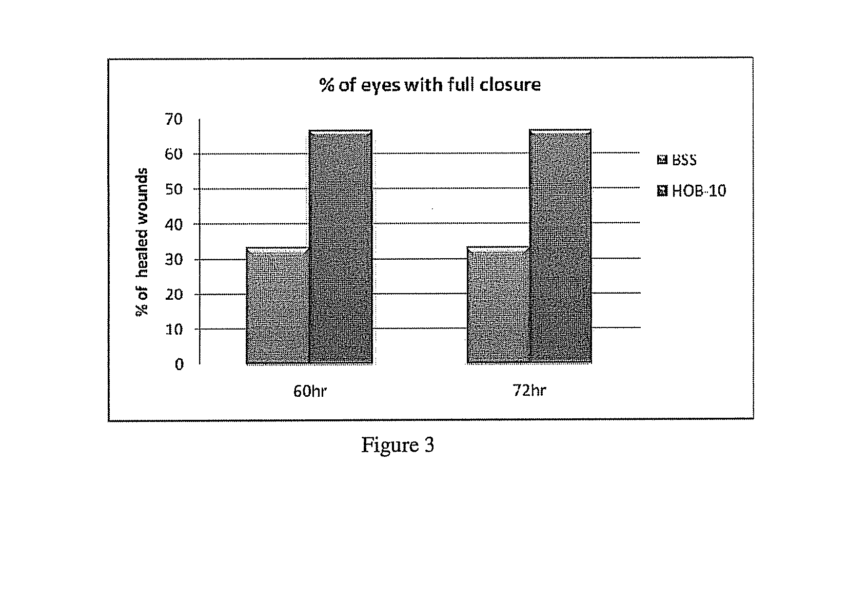 Buffered ophthalmic compositions and methods of use thereof