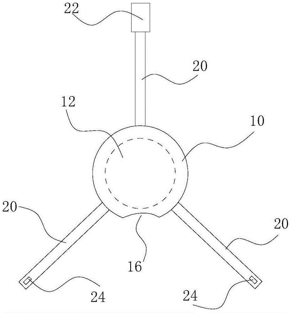 Posterior scleral reinforcement device