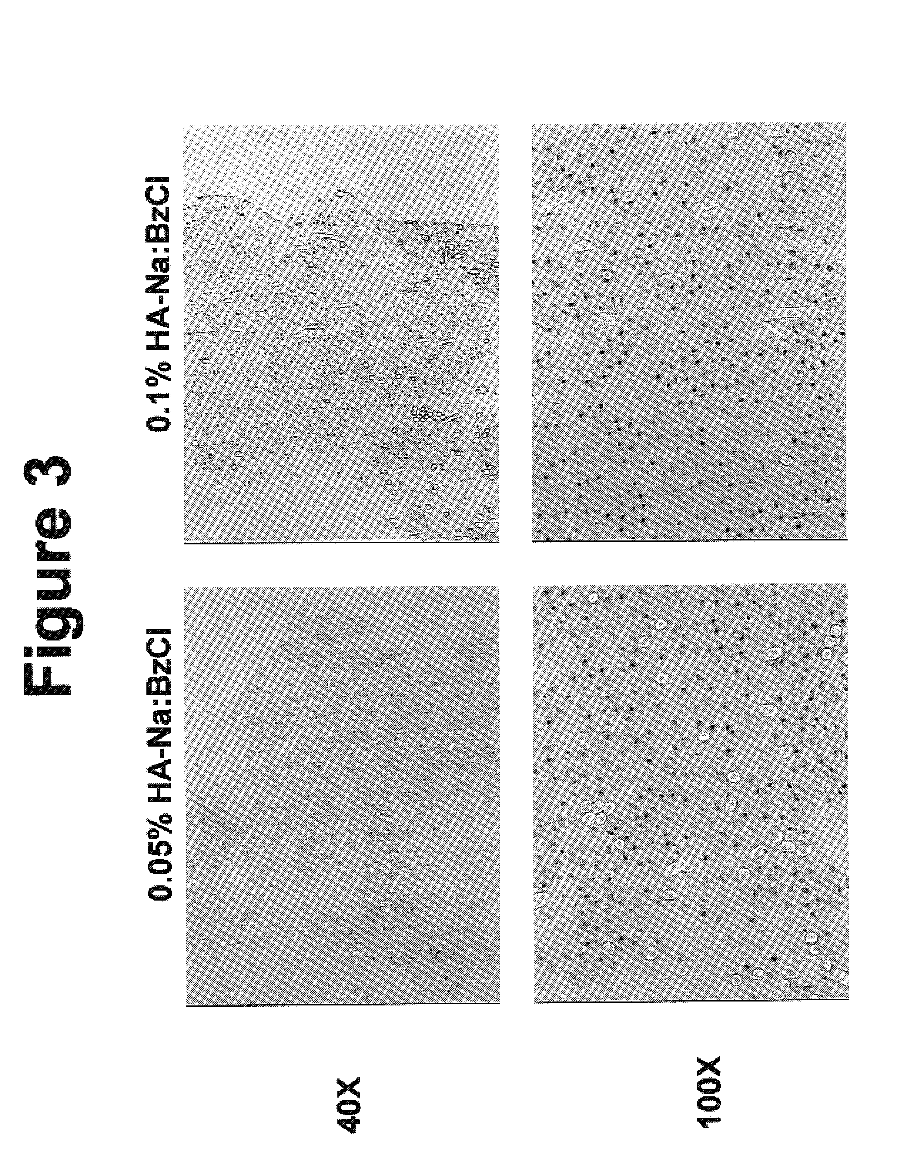 Tissue scaffolds for use in muscoloskeletal repairs