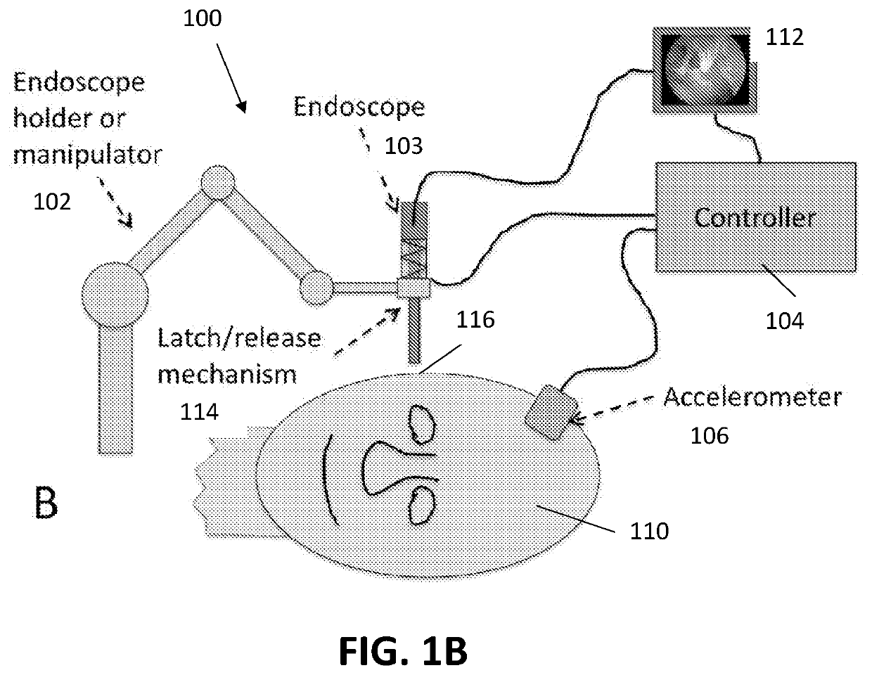 Safety feature for use with robotically manipulated endoscopes and other tools in otolaryngology and neurosurgery