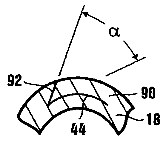 Method of corneal surgery by laser incising a contoured corneal flap