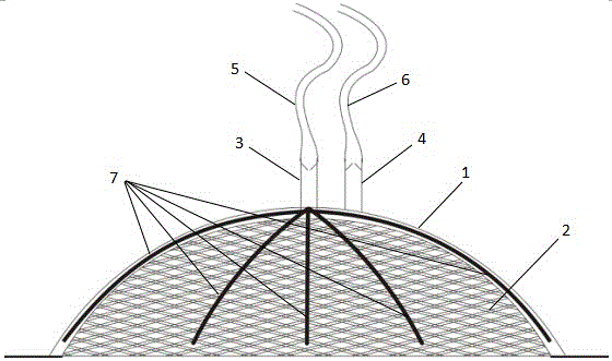 Alternative hollow negative-pressure drainage treatment system for debridement circle hydrotherapy of wounds