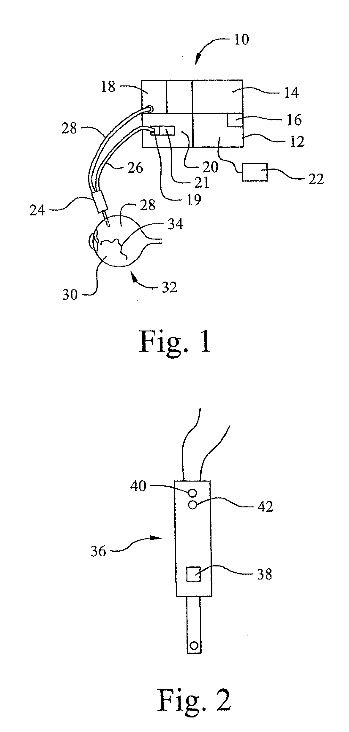 System to identify viscosity of aspirated material during ophthalmic surgery