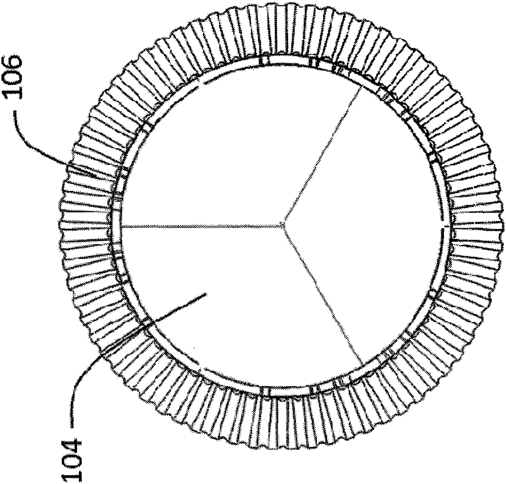 Aortic valve stents to prevent paravalvular leaks