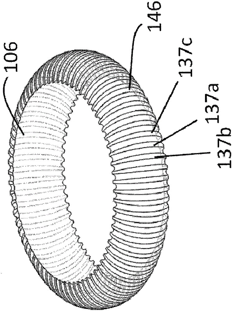 Aortic valve stents to prevent paravalvular leaks