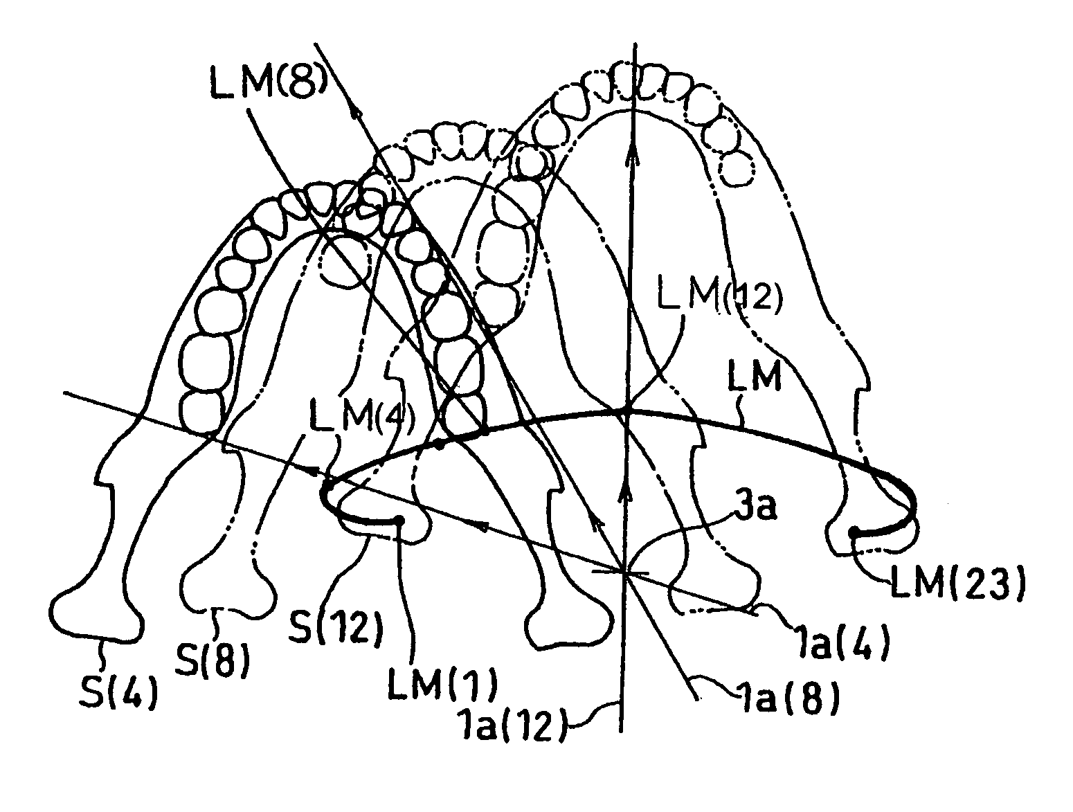 X-ray computer tomography apparatus