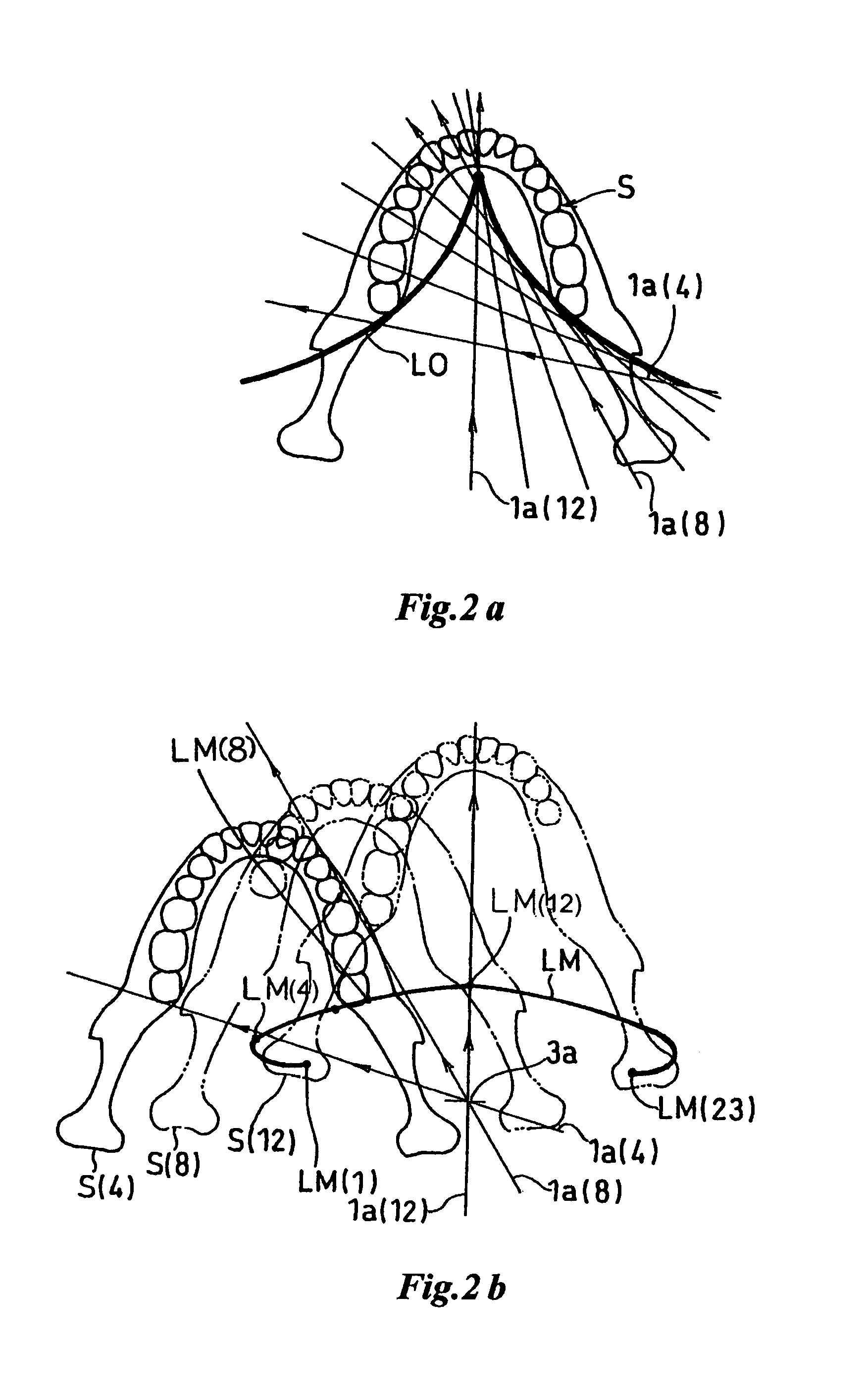 X-ray computer tomography apparatus