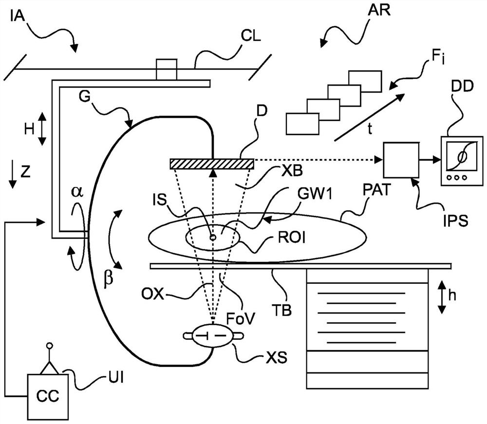 Persistent guide wire identification