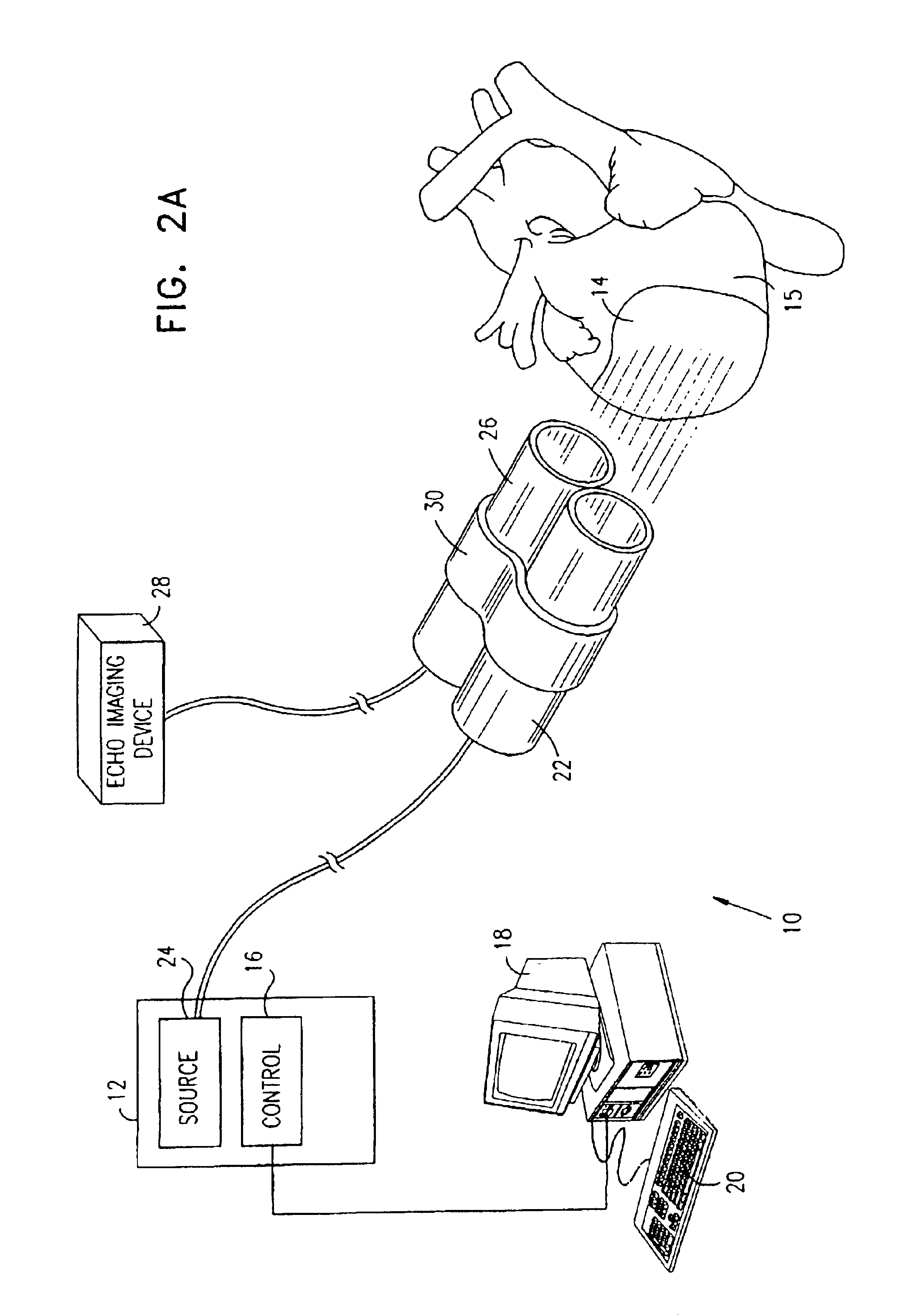 Apparatus for providing electromagnetic biostimulation of tissue using optics and echo imaging