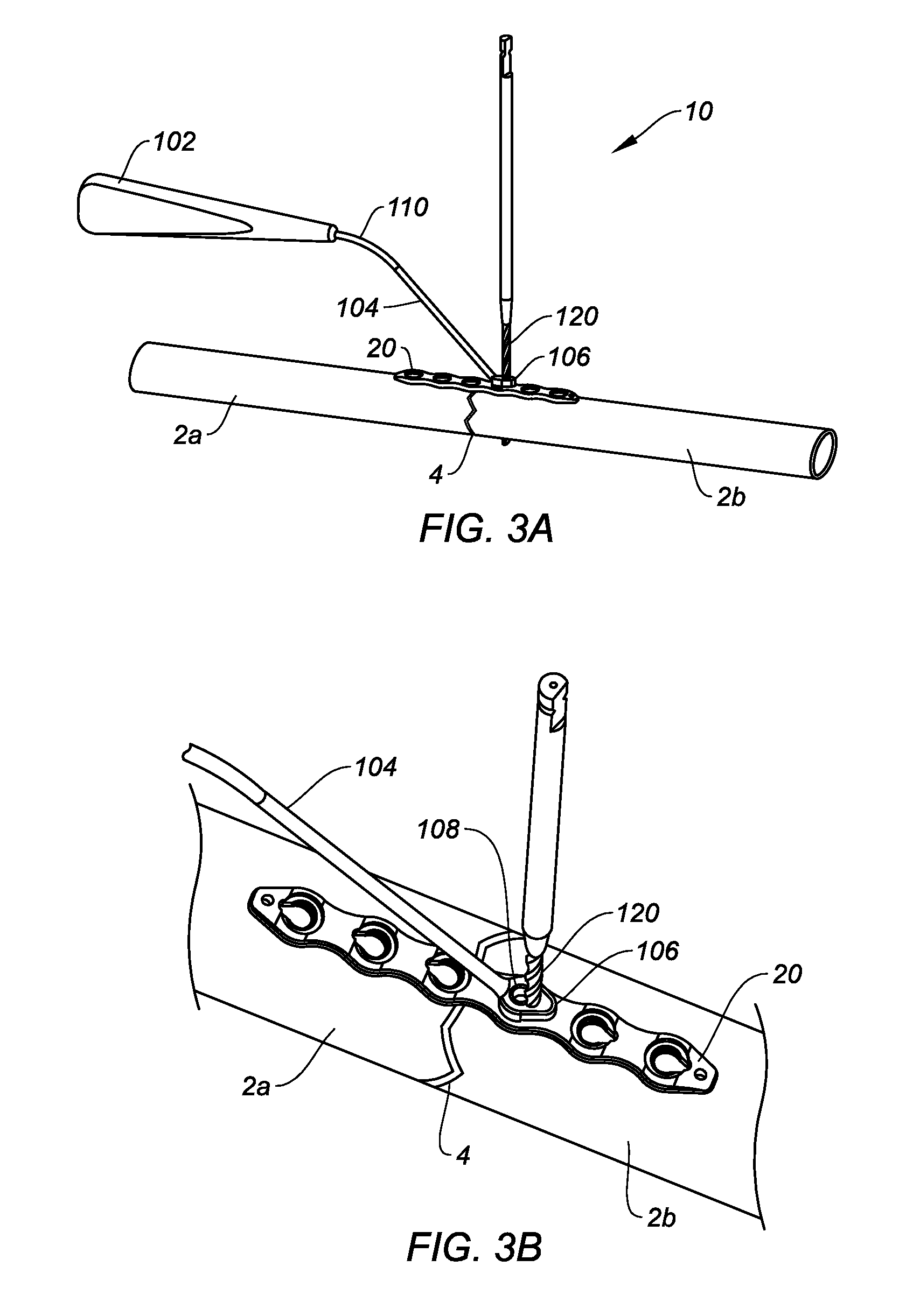 Bone plate with versatile screw holes