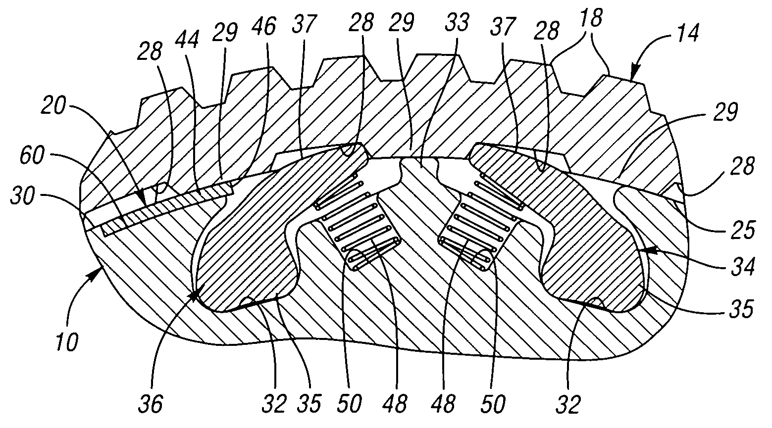 Overrunning radial coupling assembly and method for controlling the engagement of inner and outer members of the assembly