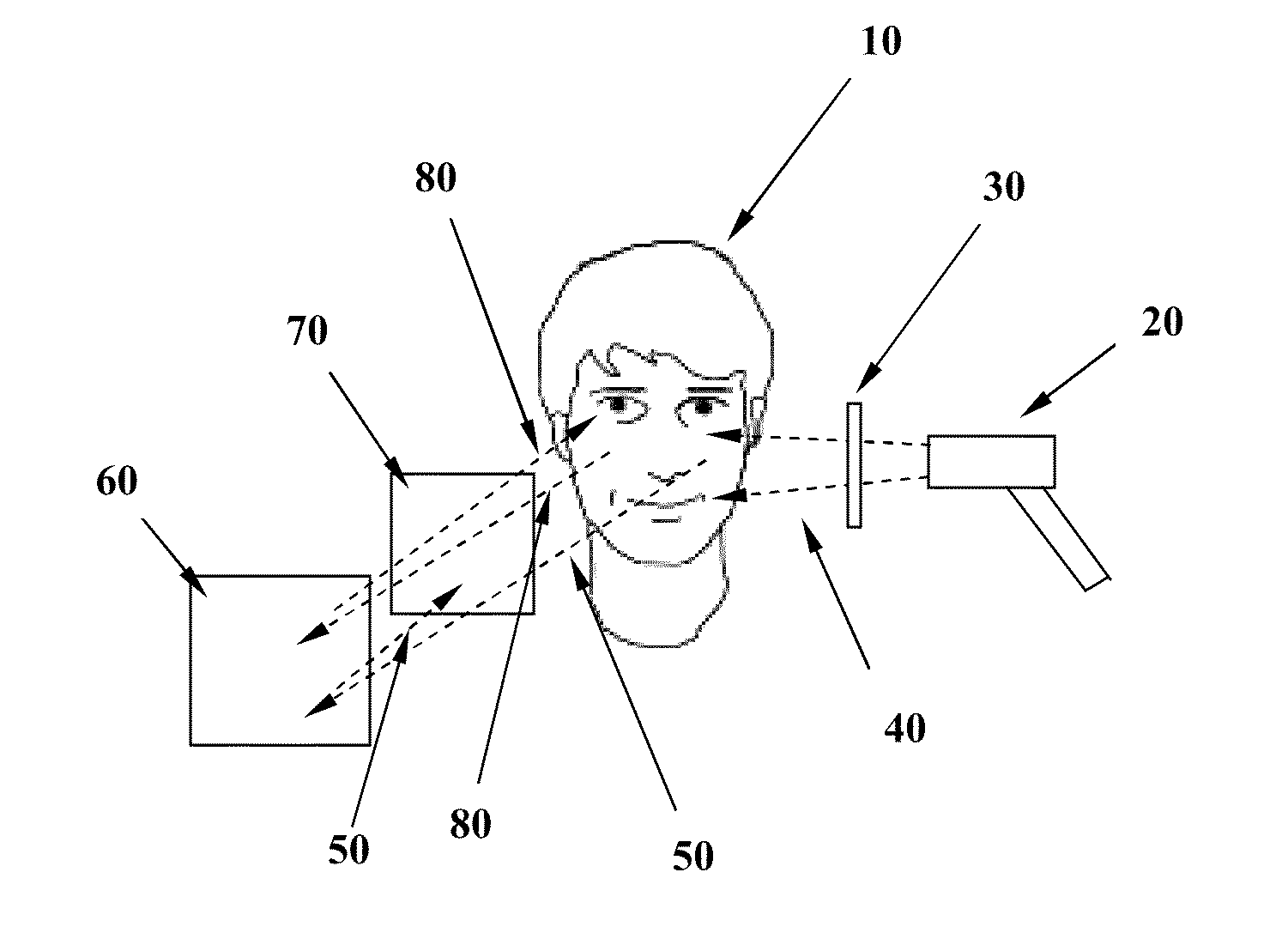 Acne Treatment Method, System and Device