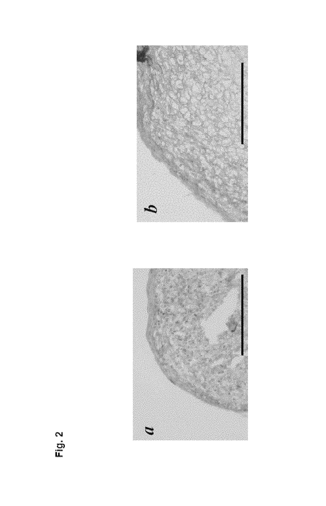 Method for preparation of cartilage cell