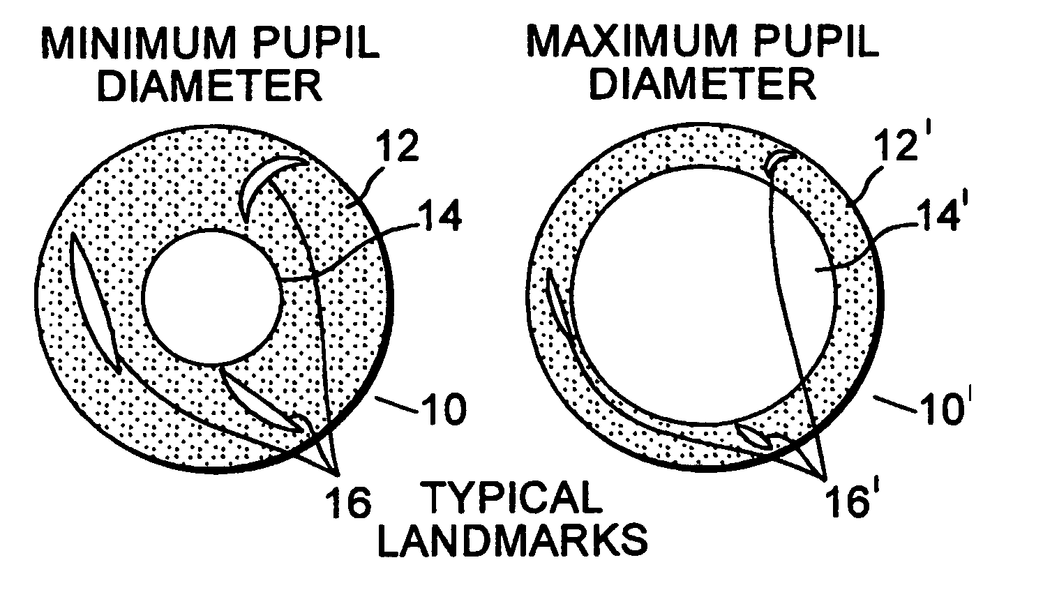 Iris pattern recognition and alignment