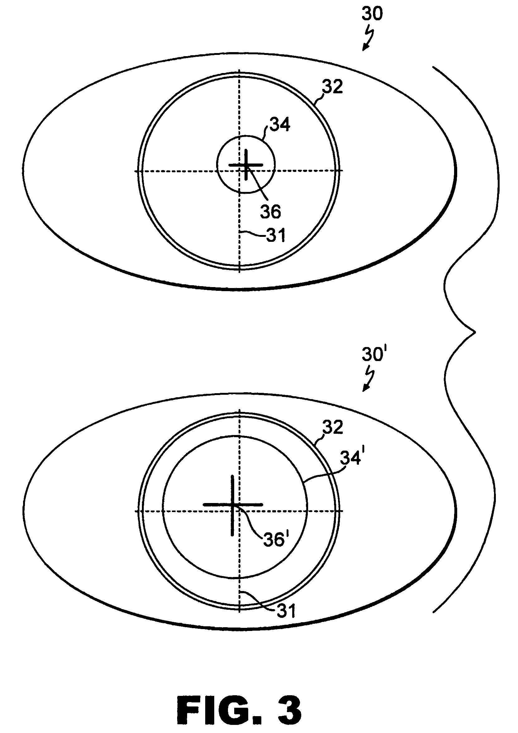 Iris pattern recognition and alignment