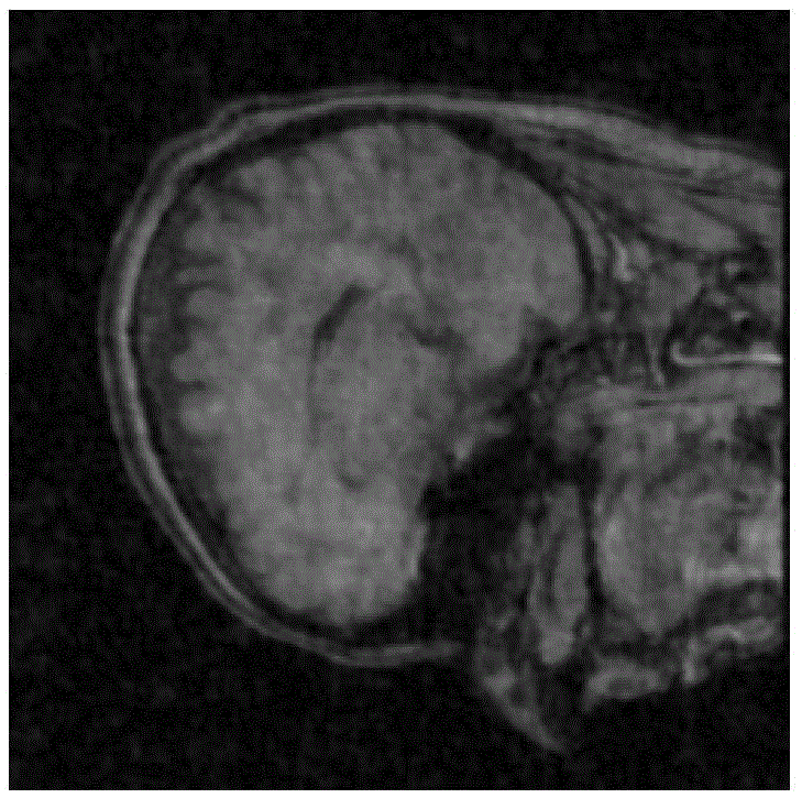 Compressive Sensing MRI Image Reconstruction Method Based on Low Rank Sparse Structure