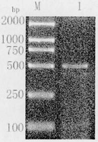 SMN gene main transition region DNA amplification method