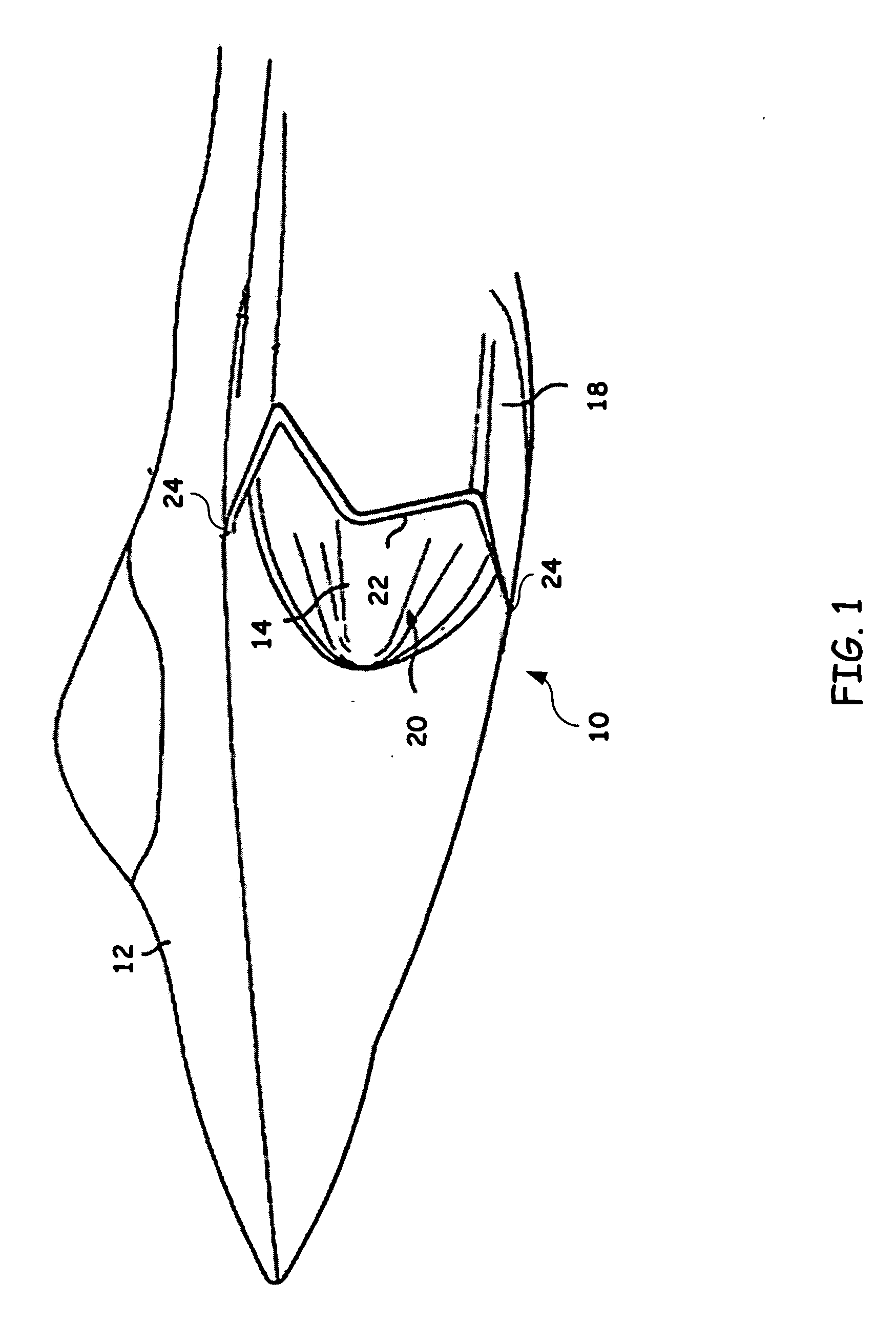 Method for streamline traced external compression inlet