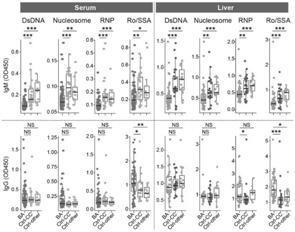 Application of reagent for inhibiting MHC-I and/or II signaling pathway in treatment of biliary atresia