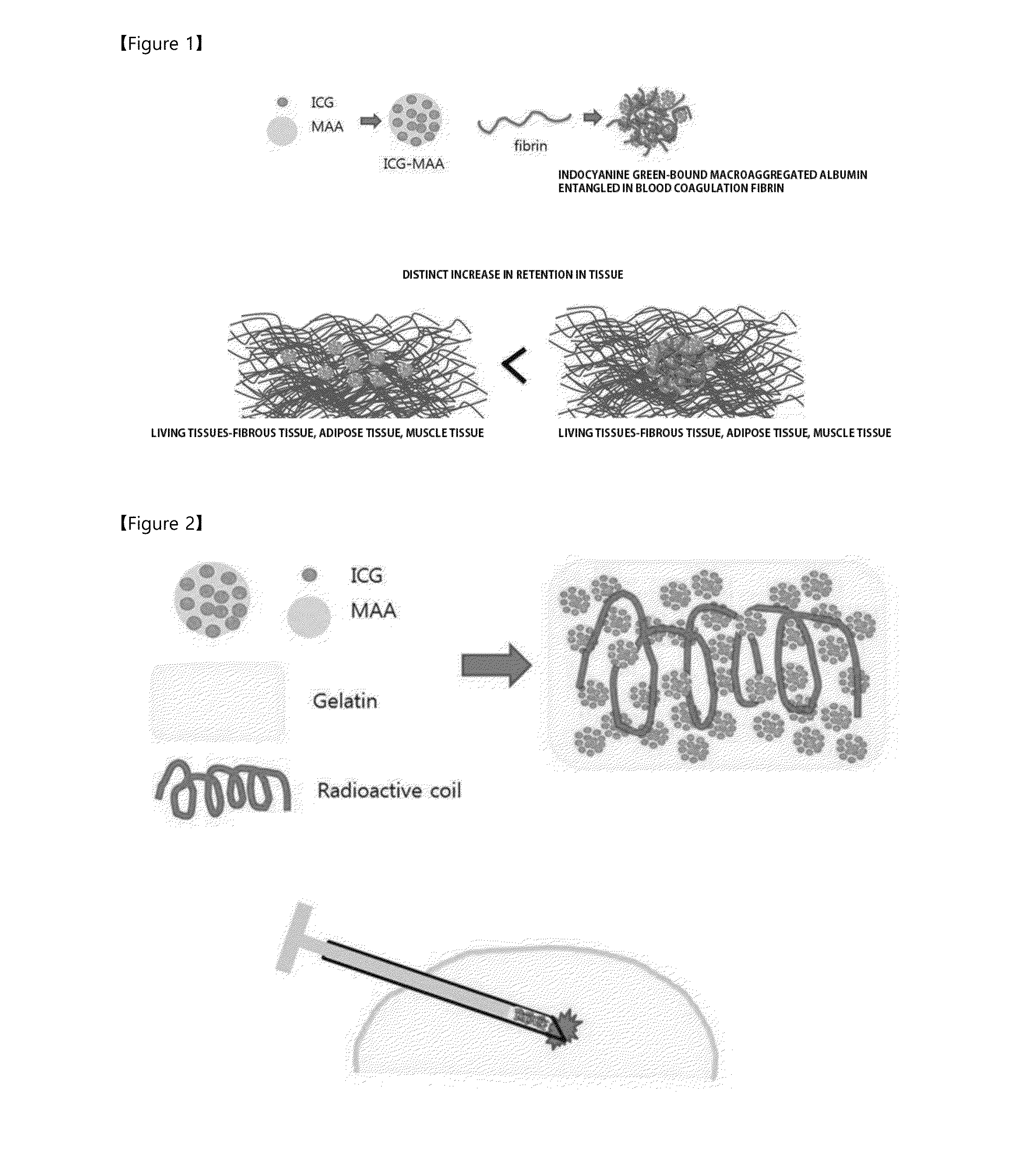 Novel labeling composition for cancer lesion