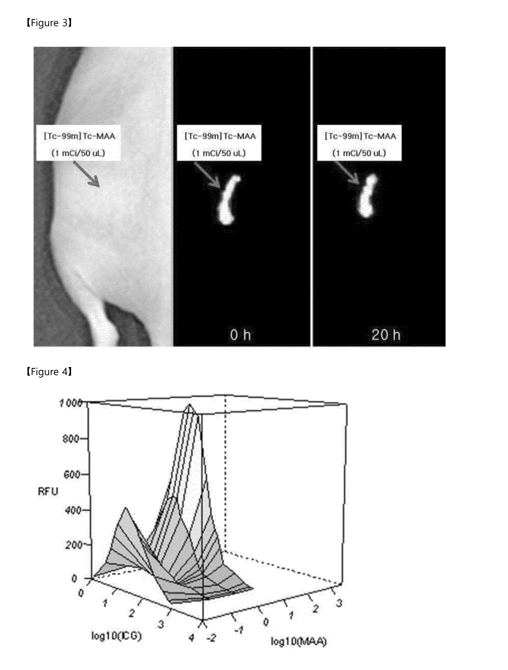 Novel labeling composition for cancer lesion