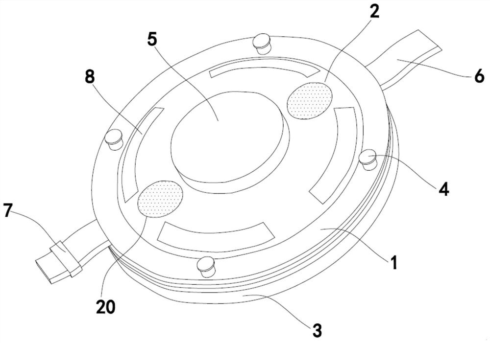 A general surgical incision recovery nursing structure