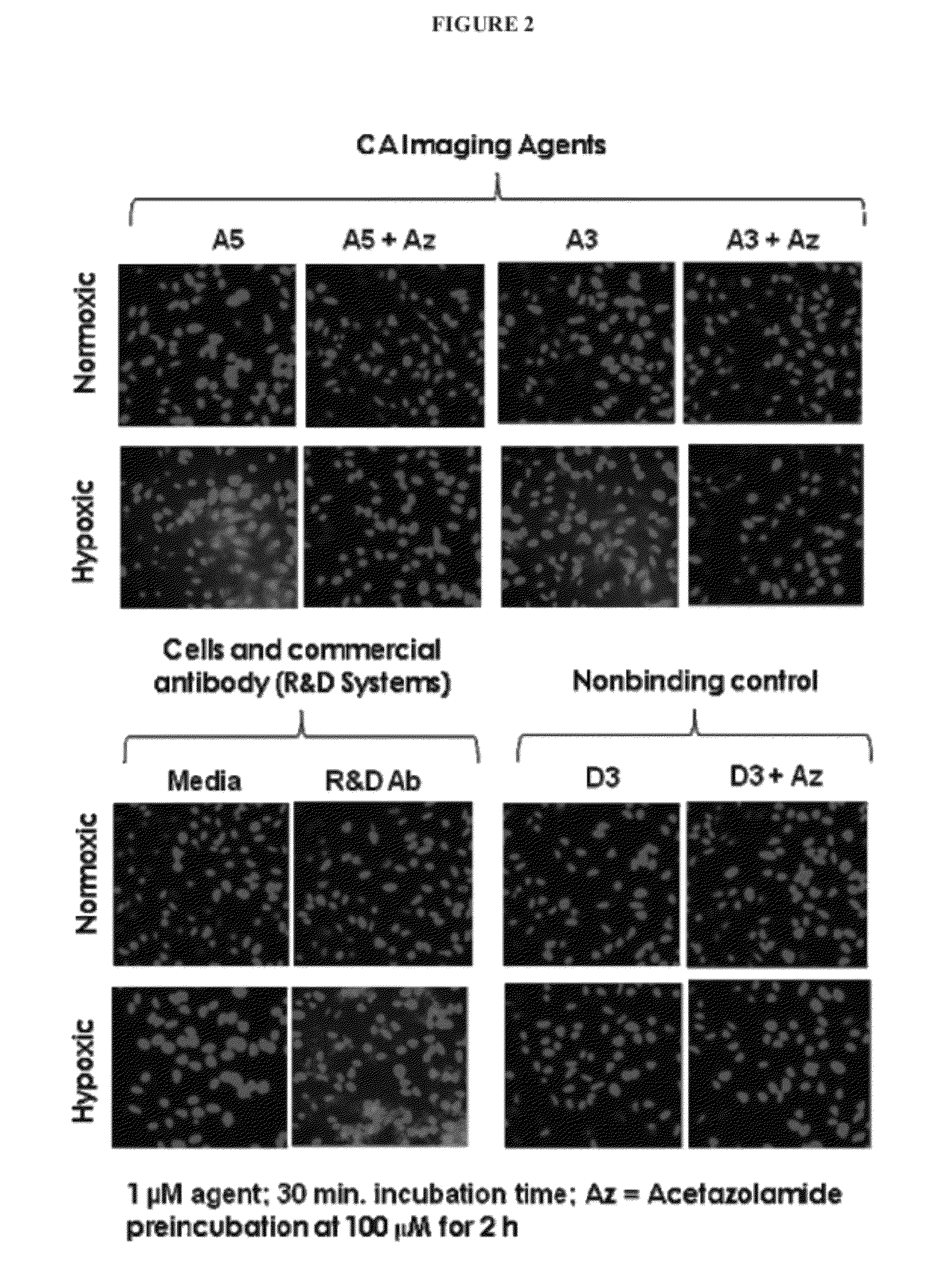 Carbonic Anhydrase Targeting Agents and Methods of Using Same