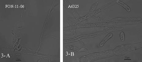 Pathogenic fonagl3 gene of Fusarium wilt of watermelon, its deletion dna fragment, deletion mutant and application thereof