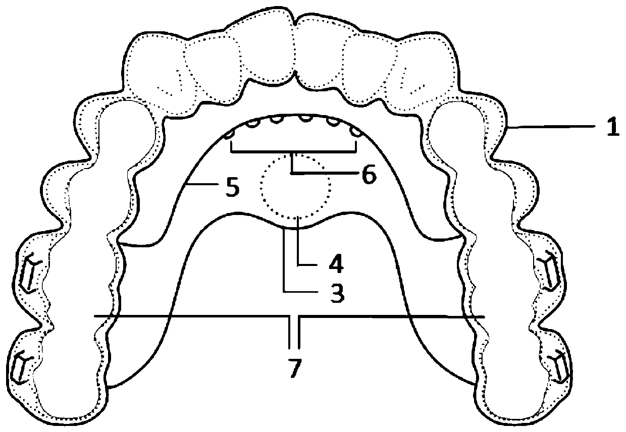 Multifunctional invisible correction appliance