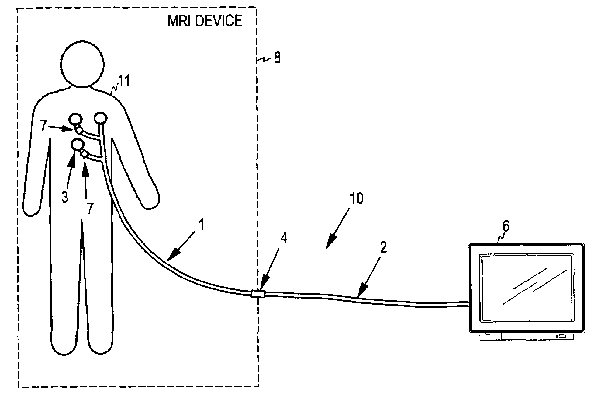 Patient cable for medical measurements