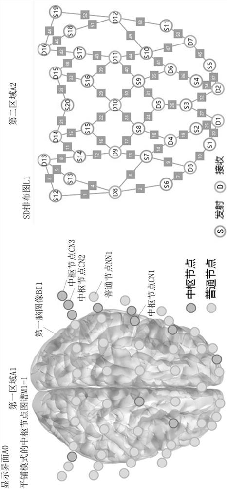 Auxiliary analysis method, device, system and storage medium for brain injury