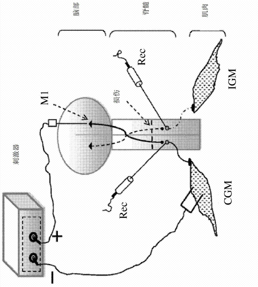 Charge-enhanced neural electric stimulation system