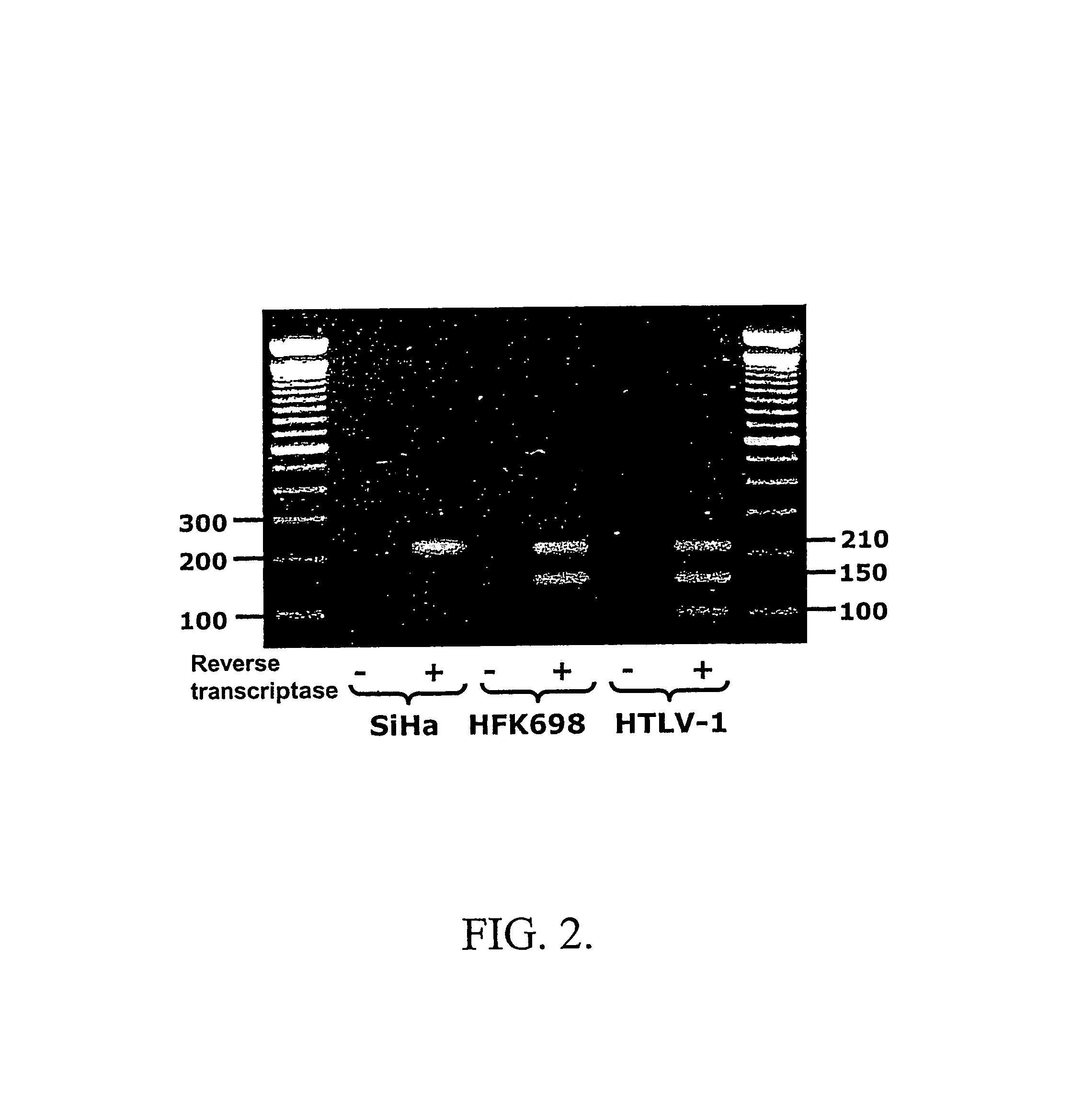 Markers for pre-cancer and cancer cells and the method to interfere with cell proliferation therein