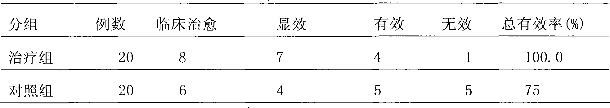 Xingnaojing nasal spray and preparation method and application thereof