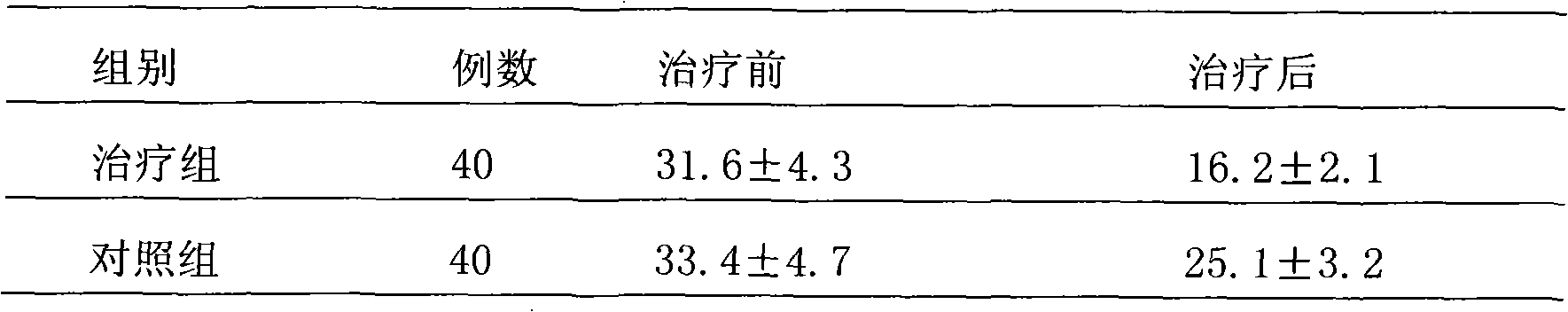 Xingnaojing nasal spray and preparation method and application thereof