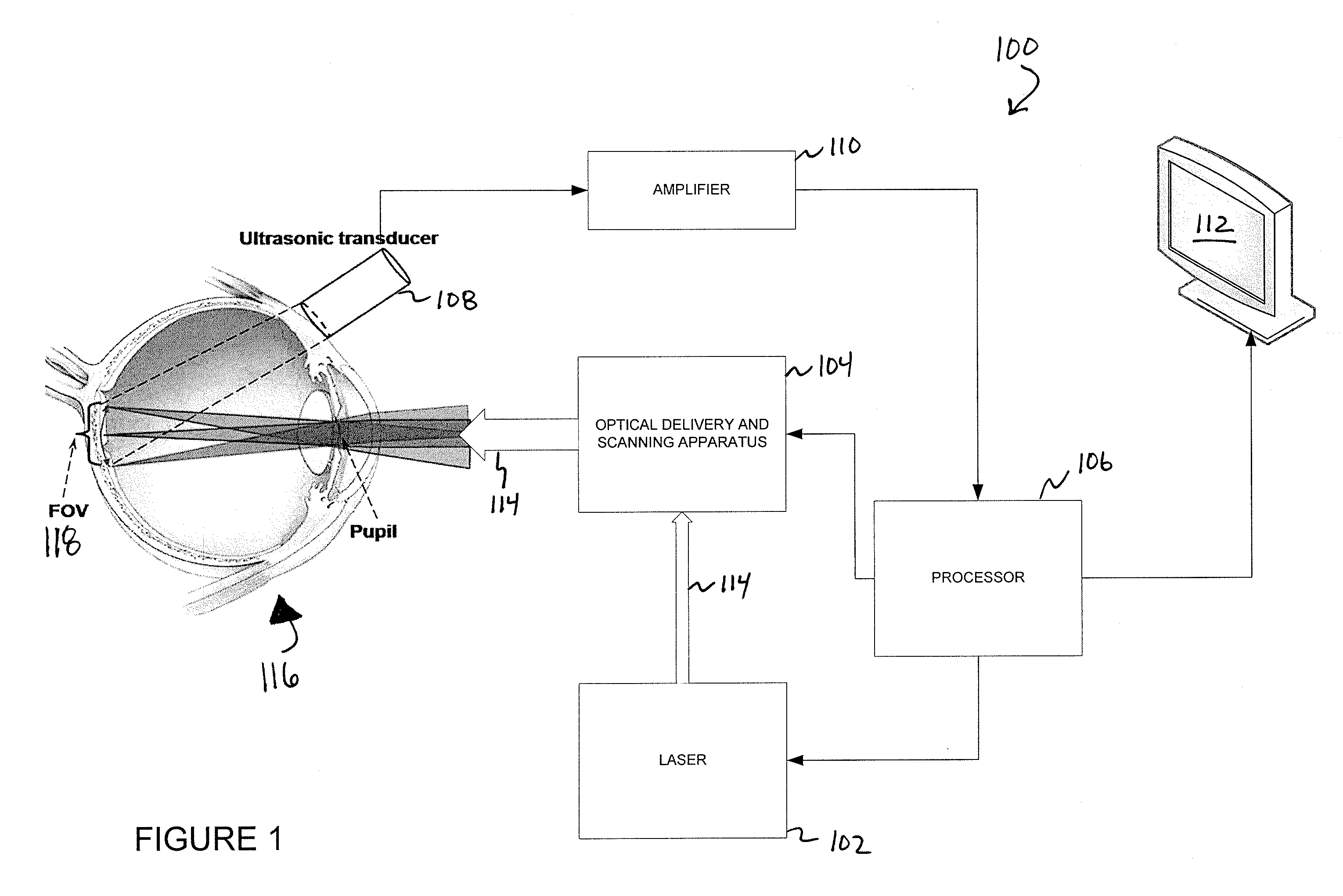 Systems and methods for photoacoustic opthalmoscopy