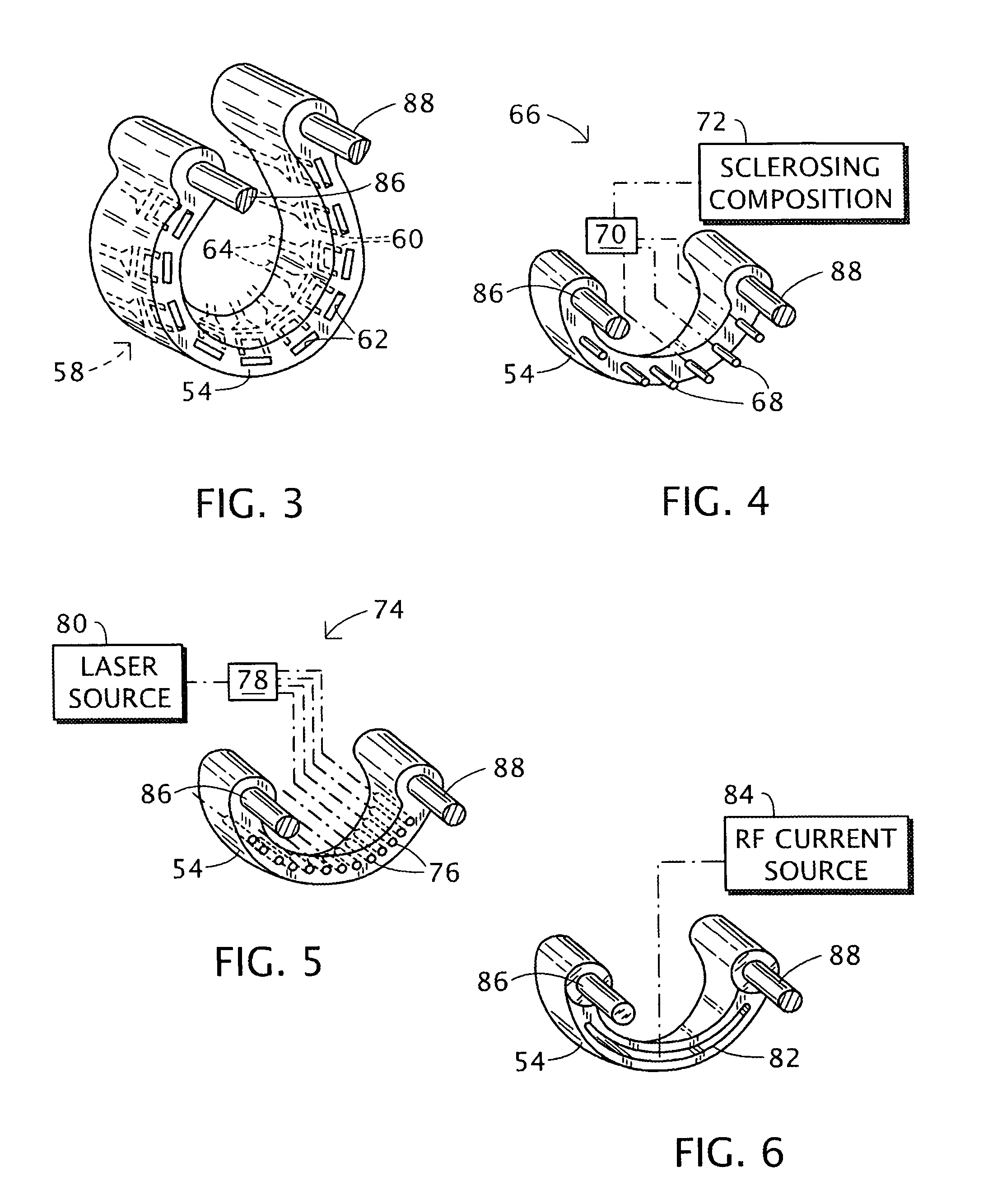 Hemorrhoids treatment method and associated instrument assembly including anoscope and cofunctioning tissue occlusion device