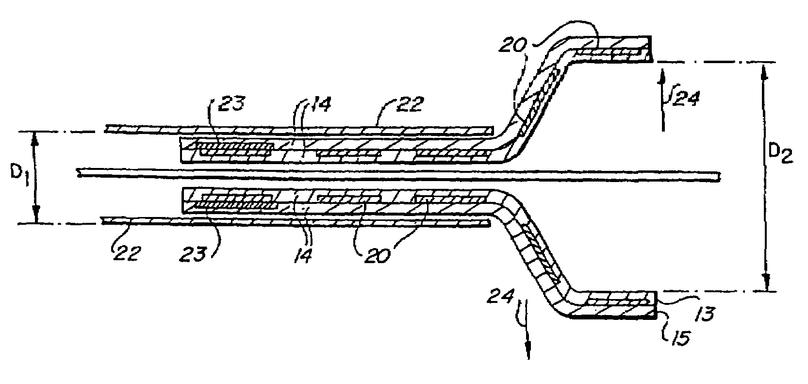 Methods for making encapsulated stent-grafts