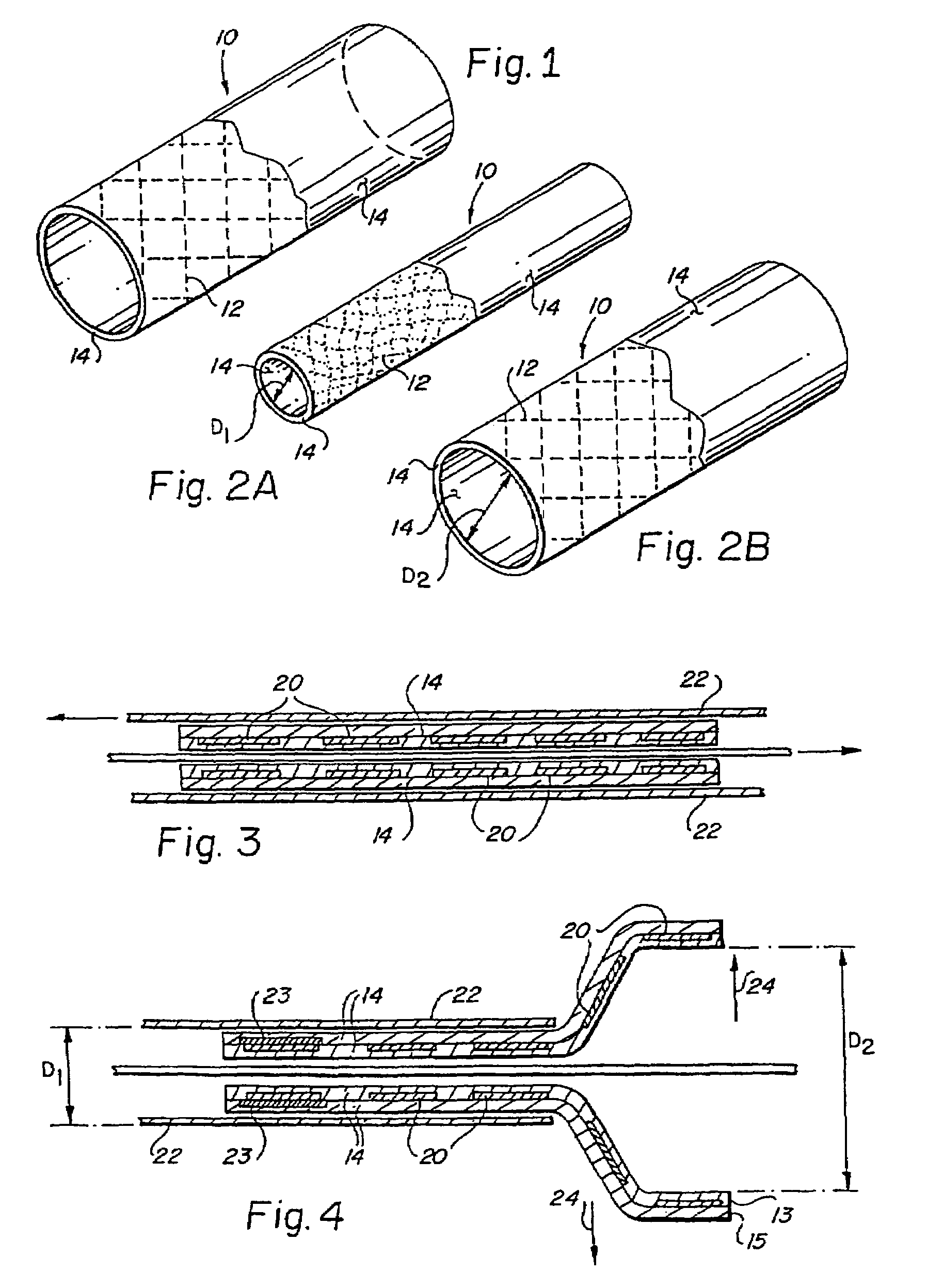 Methods for making encapsulated stent-grafts