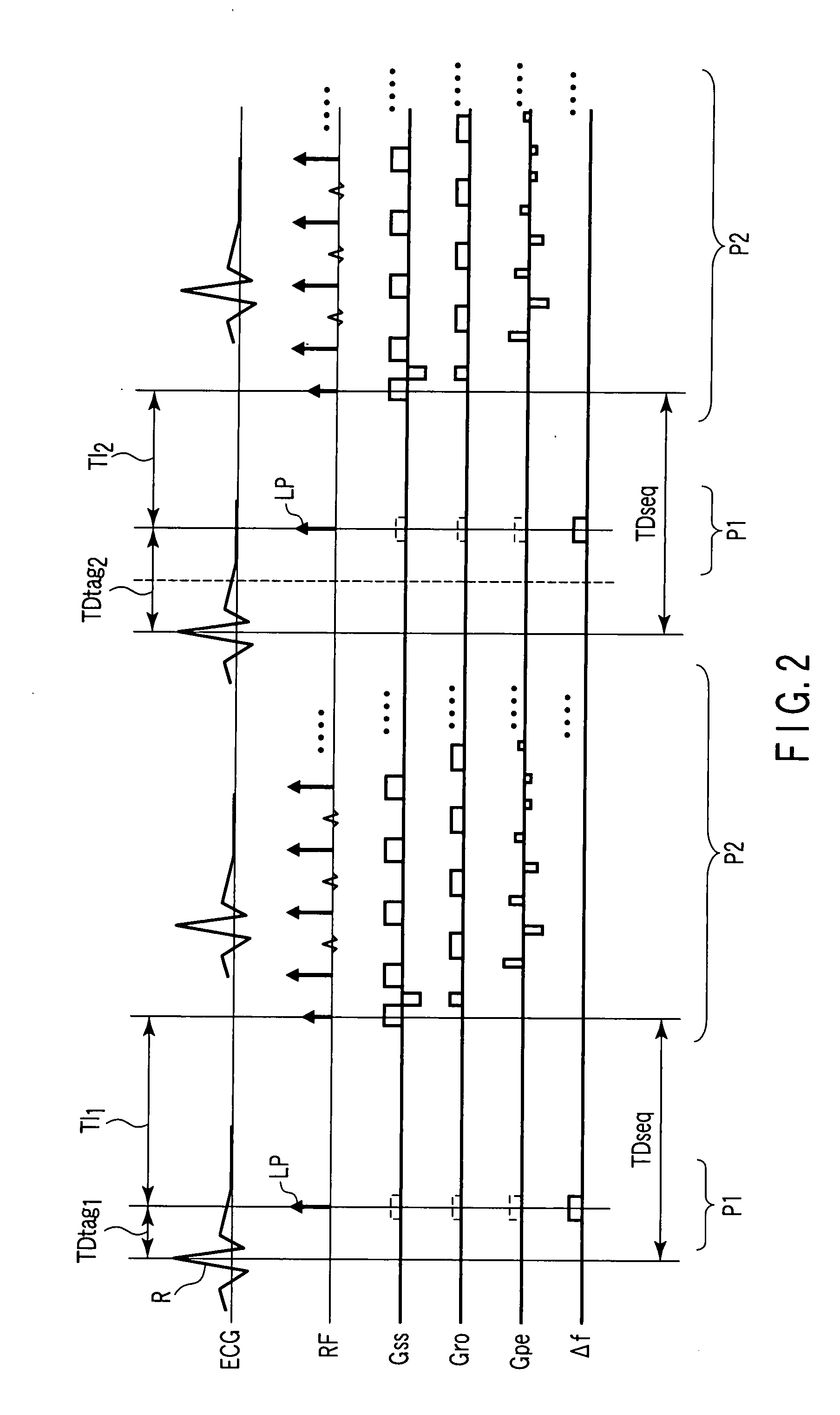 Magnetic resonance imaging apparatus and magnetic resonance imaging method