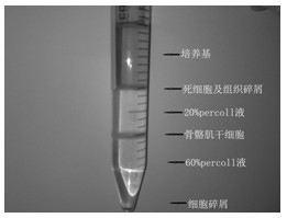 Simple extraction method of high-purity mouse skeletal muscle satellite cells