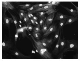 Simple extraction method of high-purity mouse skeletal muscle satellite cells