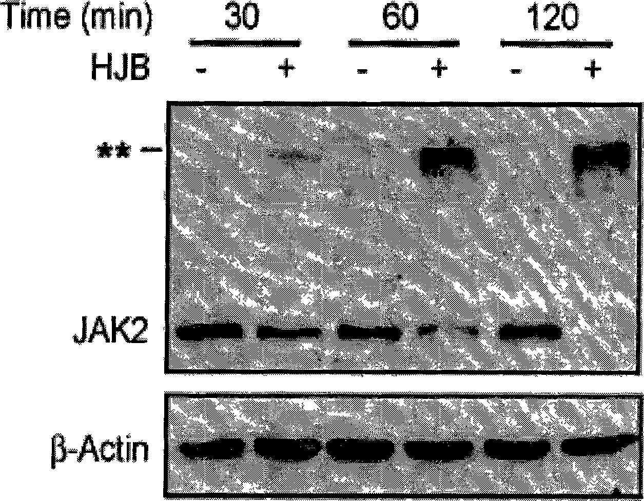 Application of diterpene ginkgolide