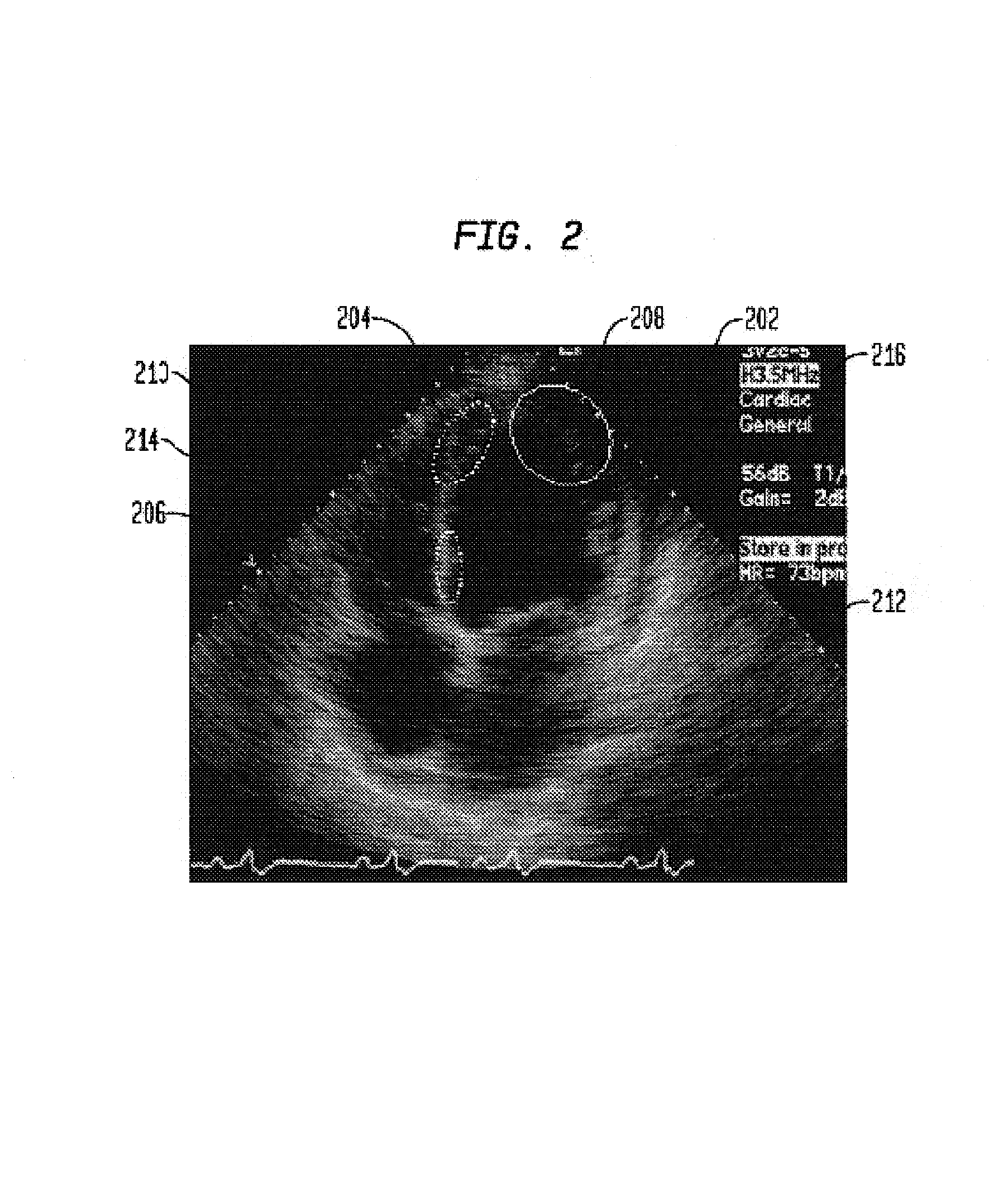 System and method for detecting and matching anatomical structures using appearance and shape