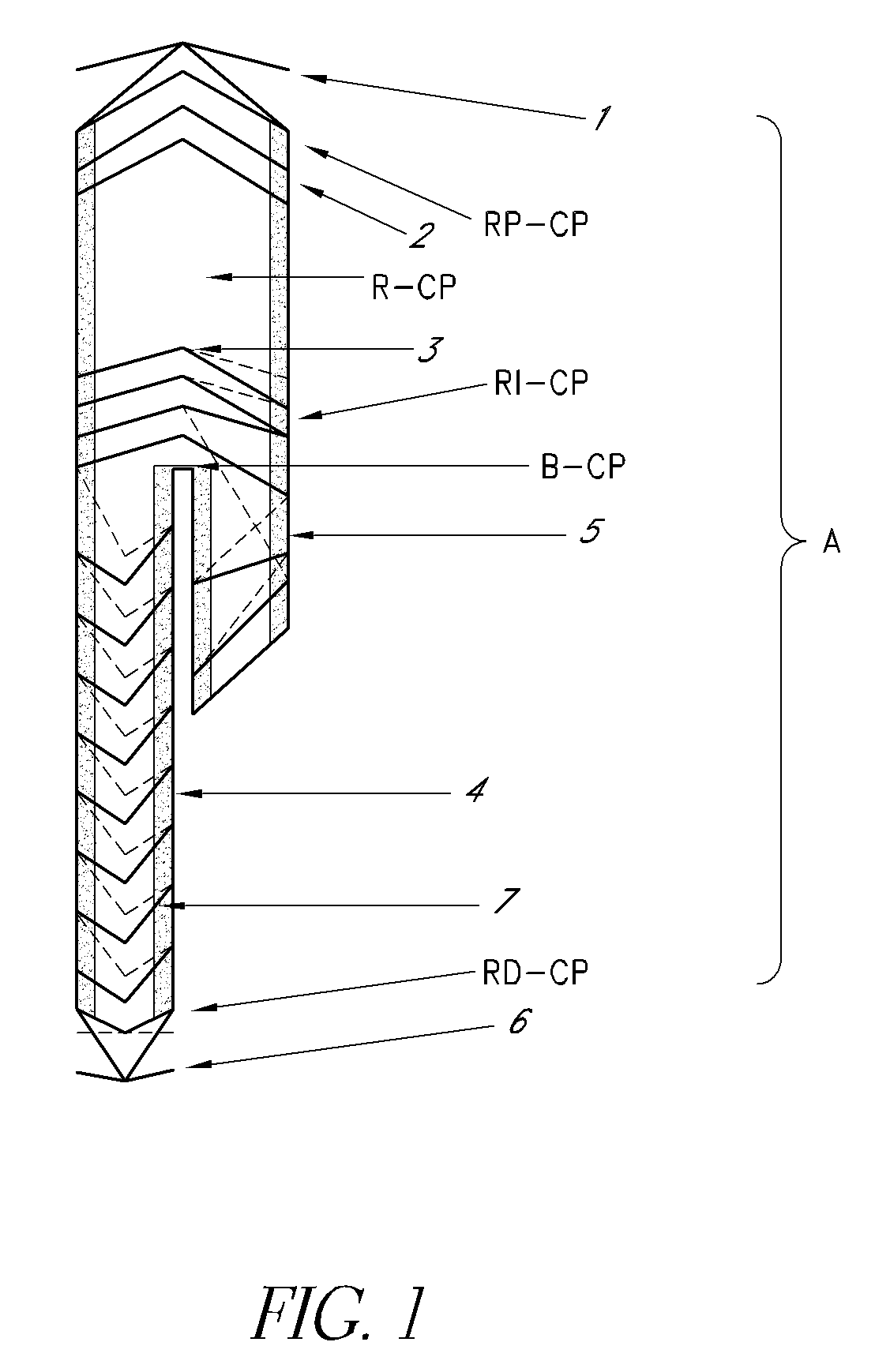 Endoprosthesis and delivery system for its placement within a patients vessel and uses for this endoprosthesis and delivery system