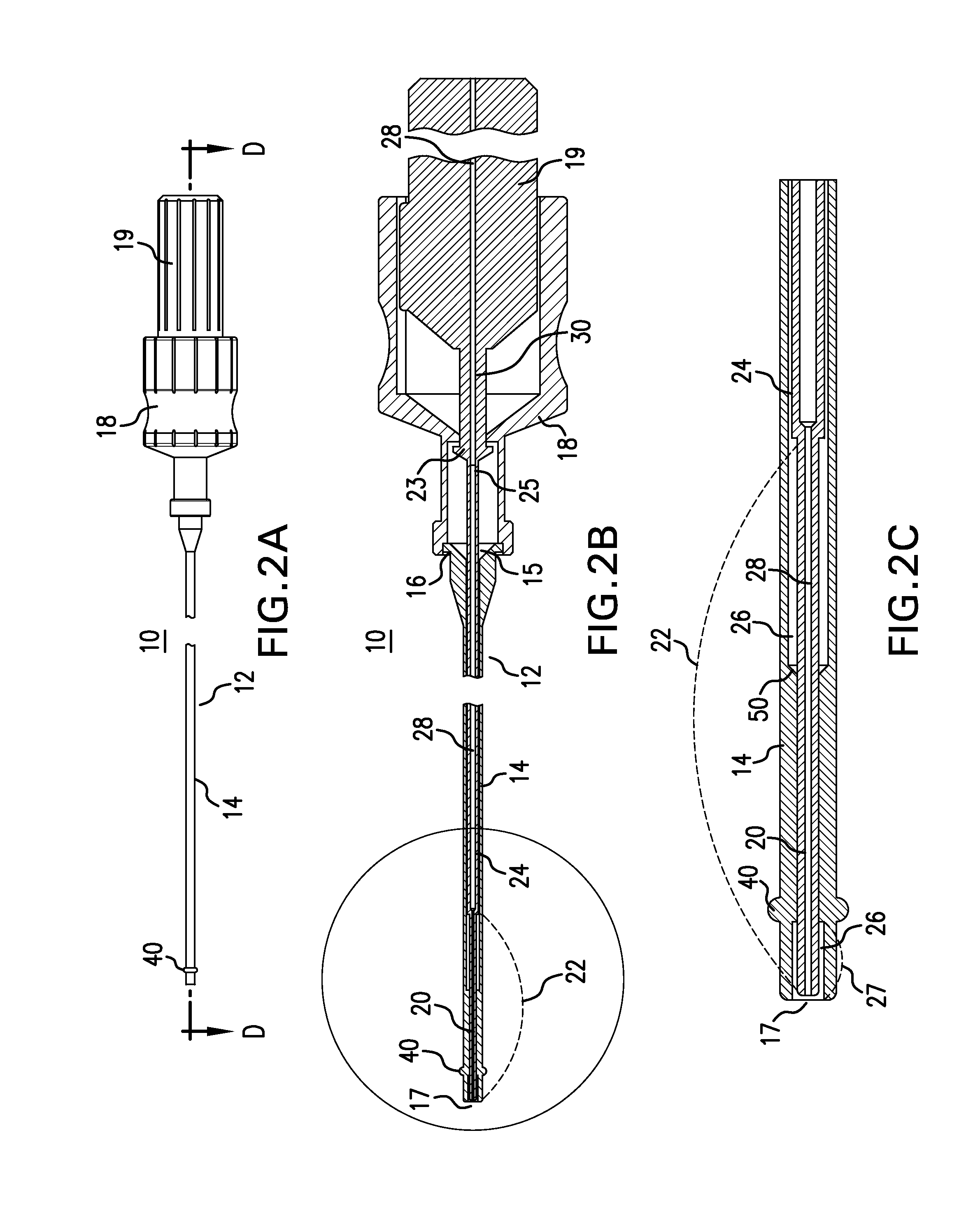 System and method for fallopian tube occlusion