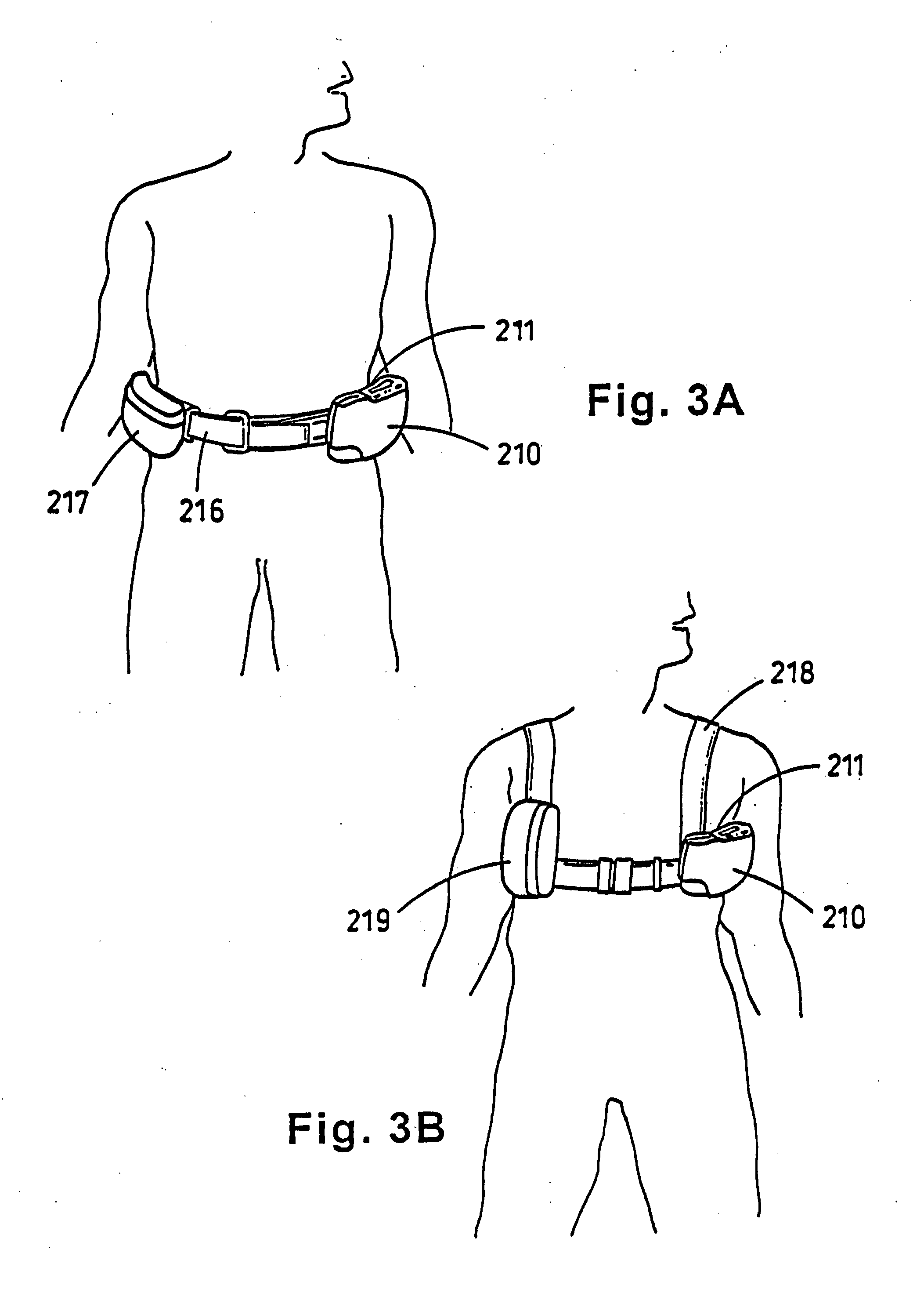 Portable wound treatment apparatus having pressure feedback capabilities