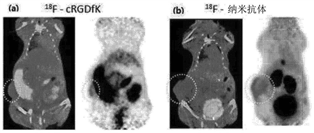 Neovascular-targeting contrast medium composition and method for preparing same